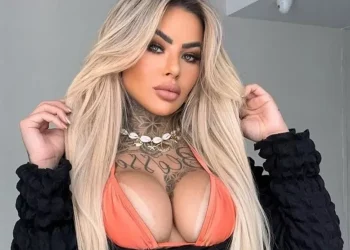 Νεκρή 27χρονη Βραζιλιάνα influencer μετά από επιπλοκές αισθητικής επέμβασης