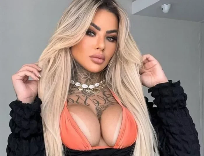 Νεκρή 27χρονη Βραζιλιάνα influencer μετά από επιπλοκές αισθητικής επέμβασης