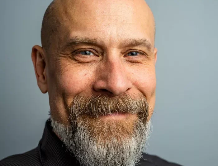 Φαλάκρα: Πολύ πιο κοντά στην οριστική θεραπεία με επαναστατική μέθοδος